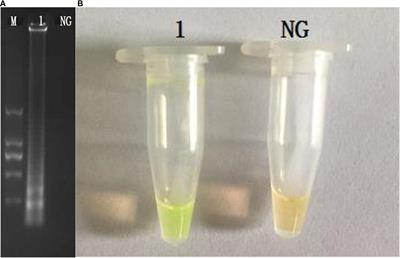 Direct Detection of Viable but Non-culturable (VBNC) Salmonella in Real Food System by a Rapid and Accurate PMA-CPA Technique